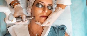 The Basics Of Hyperpigmentation Treatment